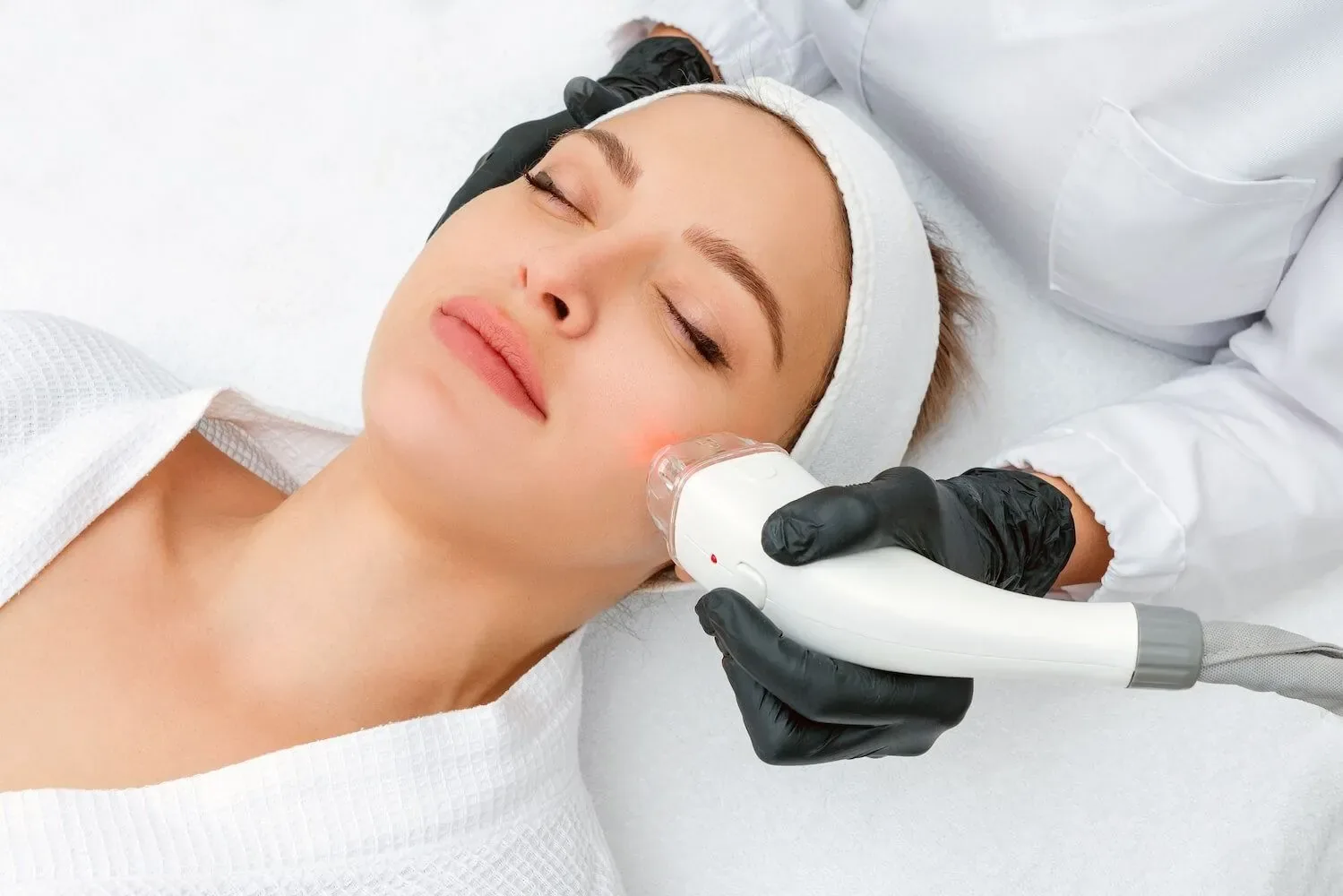 Laser skin treatment