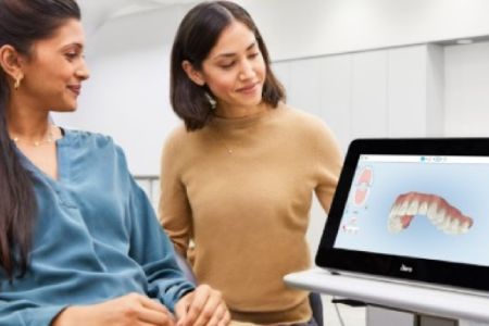 iTero digital dental scan